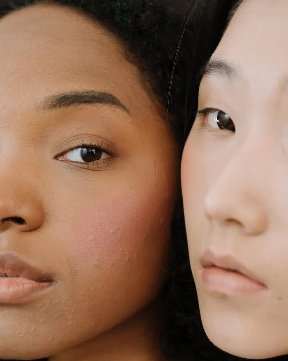 Two faces in close-up showing the cheeks, under-eye area, and chin