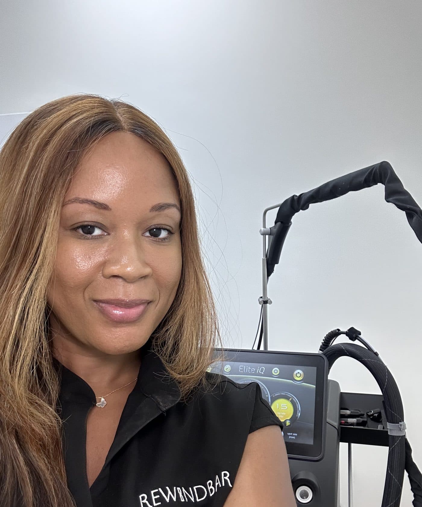 Rewind Bar provider standing beside the Cynosure Elite IQ laser